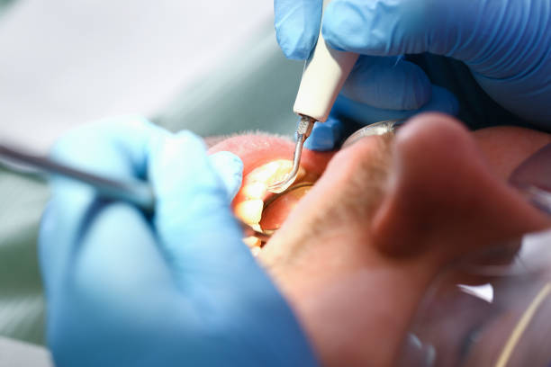Best Walk-In Emergency Dentist in Owenton, KY