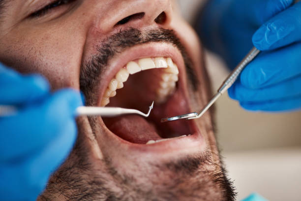 Best After-Hours Emergency Dentist in Owenton, KY